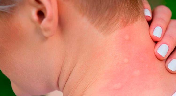 repelente-mosquitos-farmacia